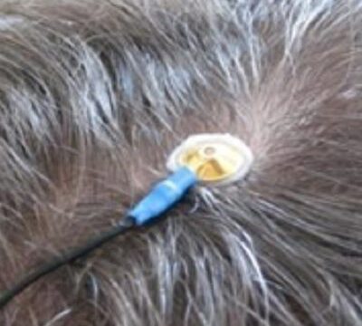 Elektrode på toppen af hovedet